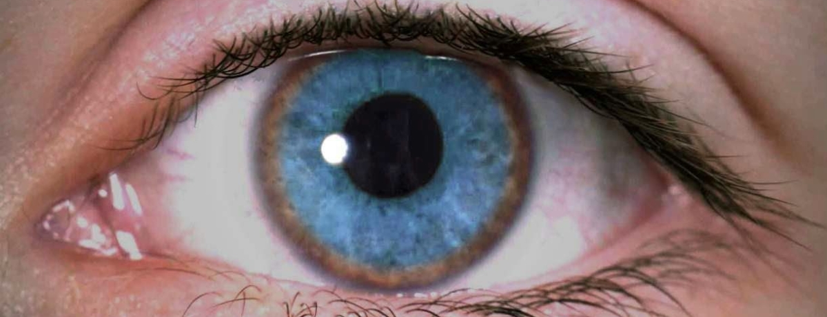Episode 16: Why do Kayser-Fleischer rings form in the cornea in Wilson disease?